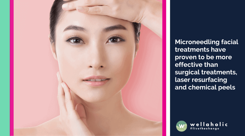 Microneedling facial treatments have proven to be more effective than surgical treatments, laser resurfacing and chemical peels