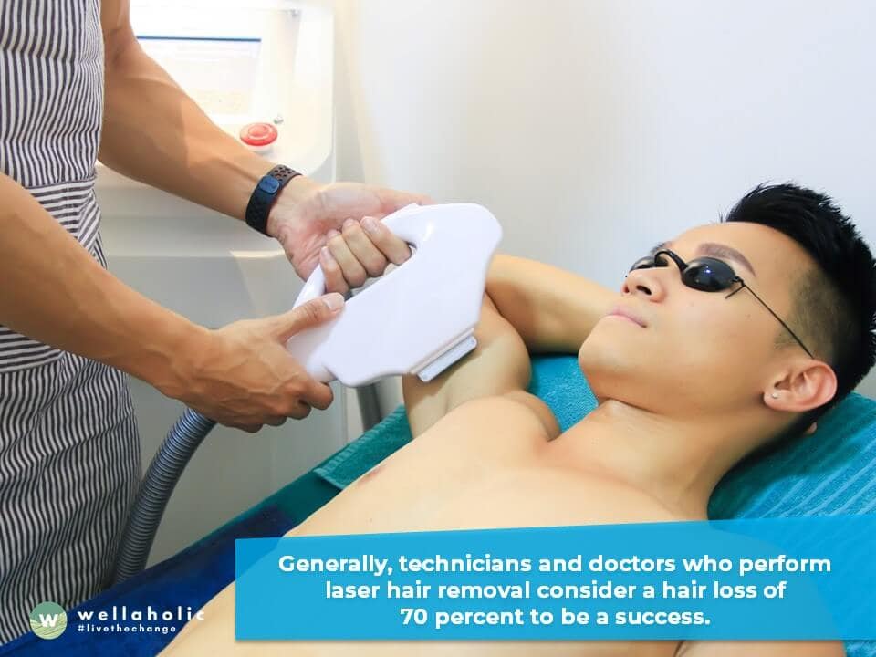 Laser hair removal is often touted as a method of 