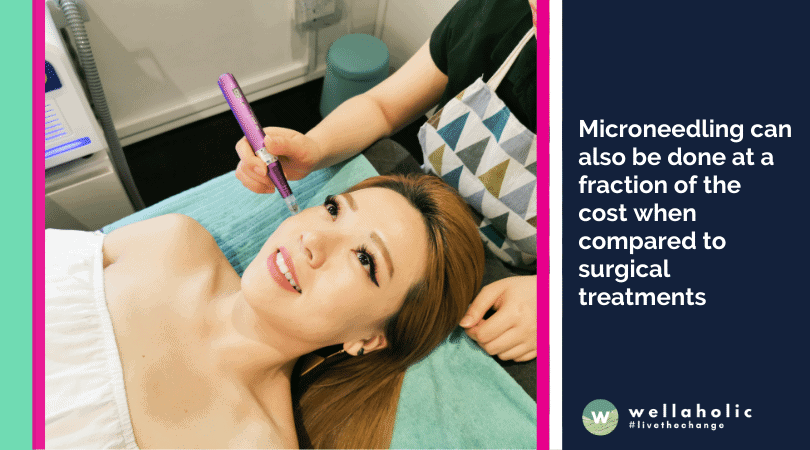 Is microneedling effective for acne scars
