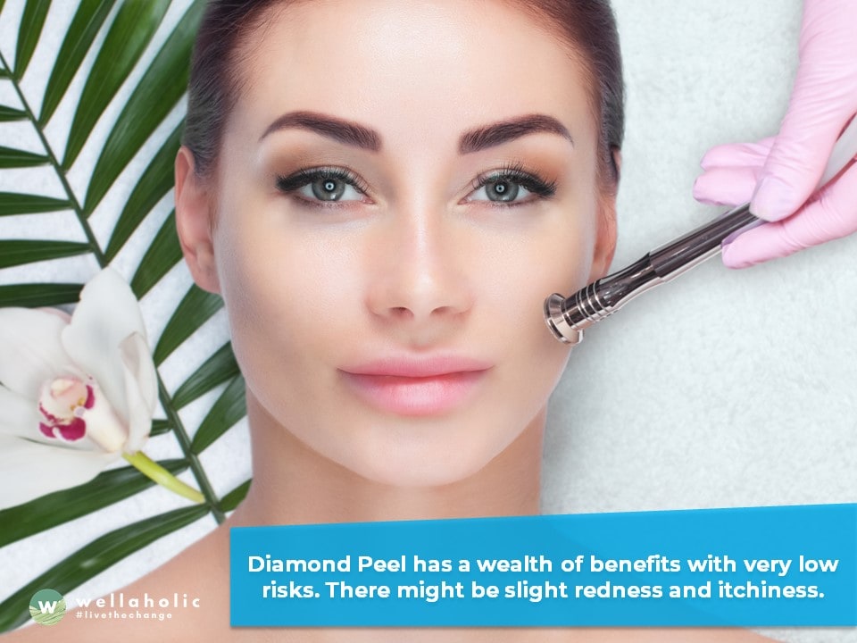 Who Should Opt for Diamond Peel Treatment?