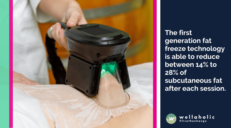 The first generation fat freeze technology is able to reduce between 14% to 28% of subcutaneous fat after each session.
