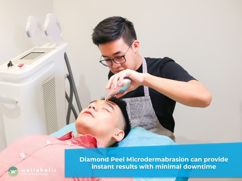 What are the Benefits of Diamond Peel?