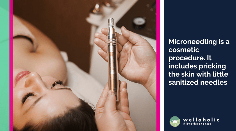 Microneedling is a cosmetic procedure. It includes pricking the skin with little sanitized needles