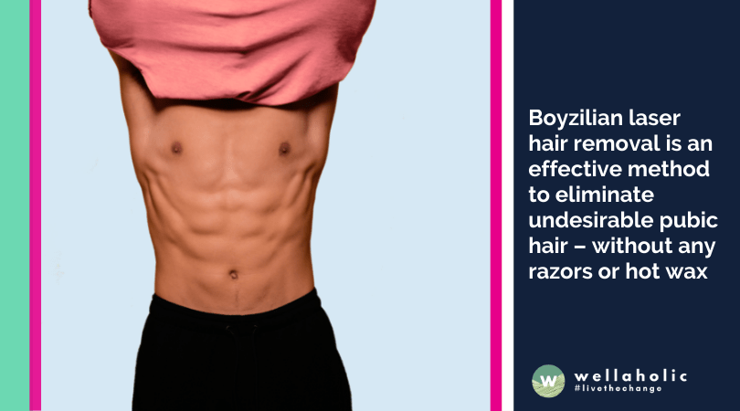 Boyzilian laser hair removal is an effective method to eliminate undesirable pubic hair – without any razors or hot wax