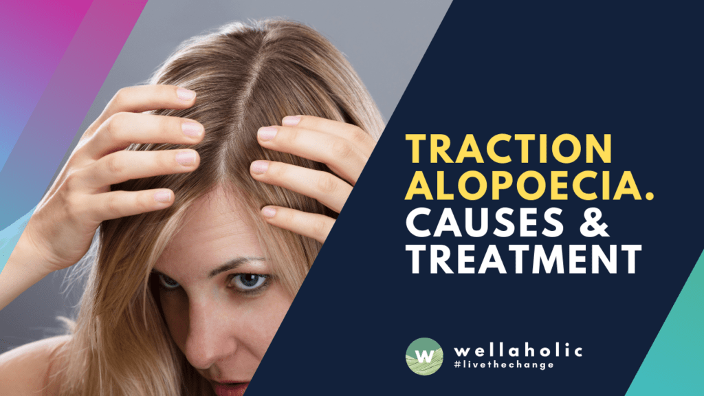 Introduction to Traction Alopecia