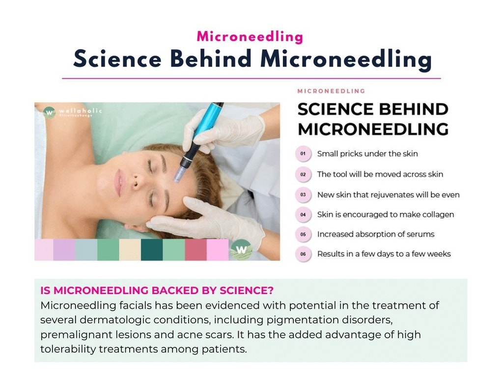 Science Behind Microneedling