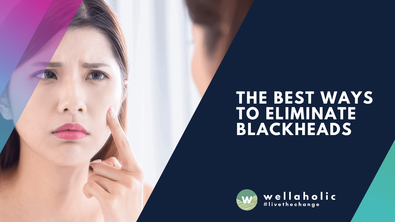 The Best Ways to Eliminate Blackheads
