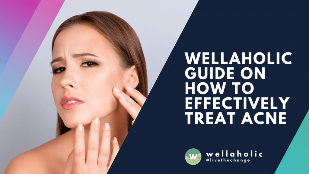 Wellaholic Guide on How to Effectively Treat Acne