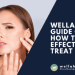 Wellaholic Guide on How to Effectively Treat Acne