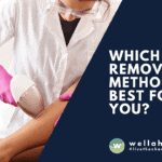 which hair removal method is best for you